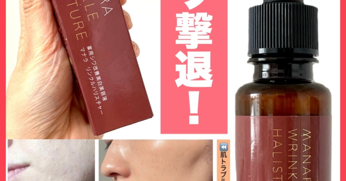 シワと戦うあなたへ♡国が認めたシワ改善成分・ナイアシンアミド配合の