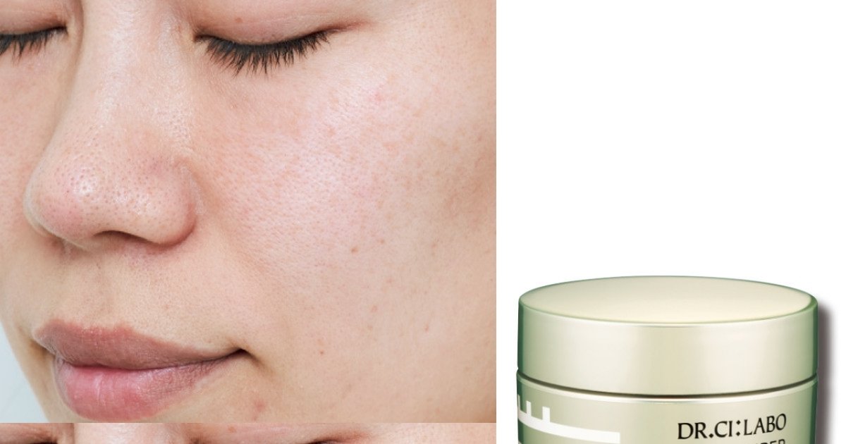 シーラボ 美白クリーム ビタミンCはすごかった！ ドクターシーラボの美白クリームを30