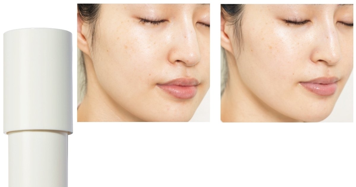 友利先生がお見立て！受賞コスメの「ディセンシア ホワイトF／L