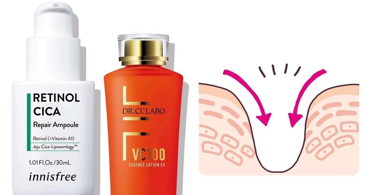 先手はコラーゲンケア、後手はリフトアップ！ 友利 新先生が教える