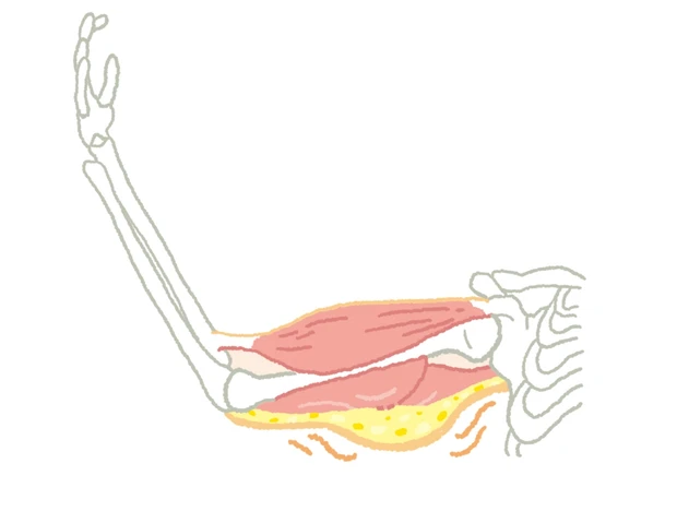 筋肉・脂肪・皮膚のトリプルたるみ発生