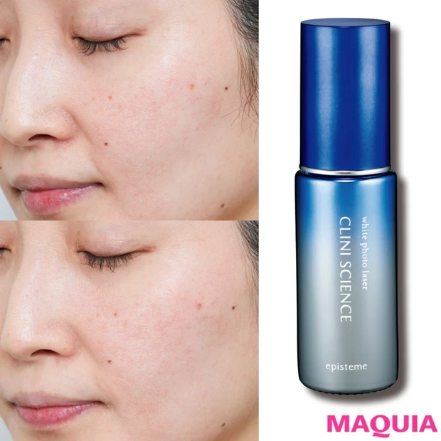 頑固なシミにはエピステーム一択！ 気になる実力を30日間チャレンジで証明