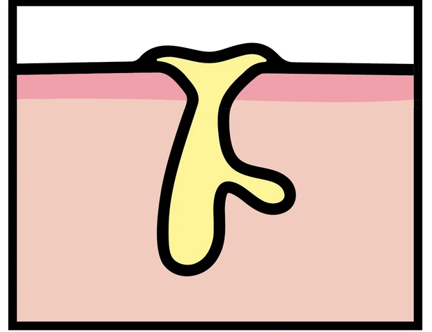 【悩み別】毛穴を目立たなくする方法 PhotoGallery_1_6