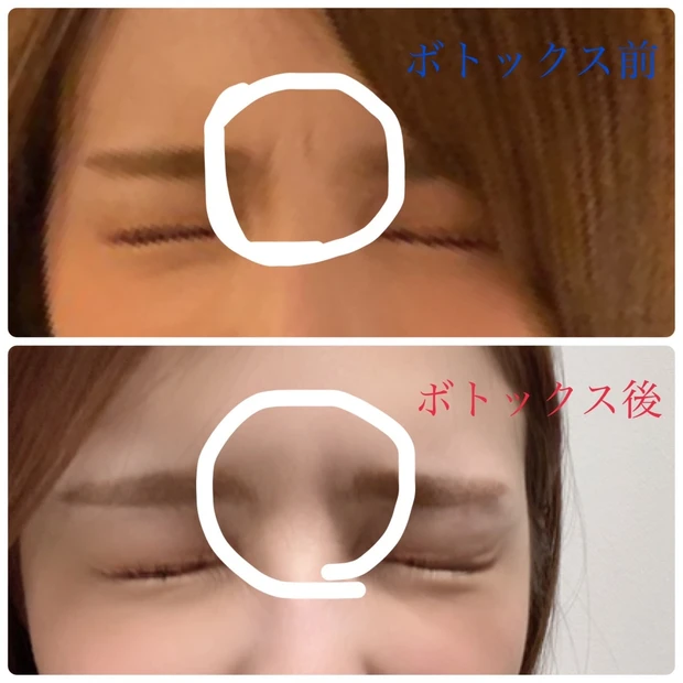 【スキンチェック】【美肌診断】いろいろ美容について気にかけてきたけど、実際自分の今の肌の状態ってどうなの?!【未来シワ】【シミ予備軍】_3