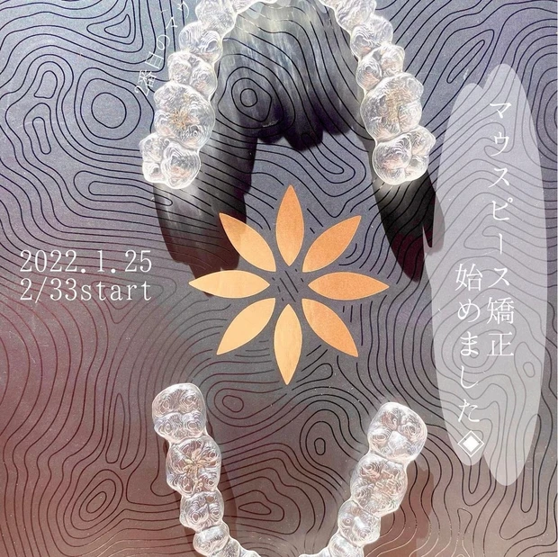 2022年1月 マウスピース矯正を始める