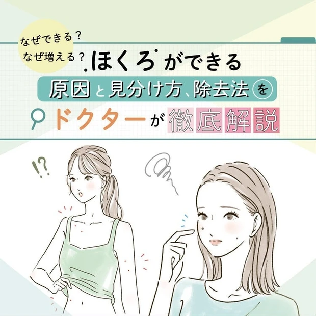 「なぜできる？ なぜ増える？」ほくろができる原因と見分け方、除去法をドクターが徹底解説