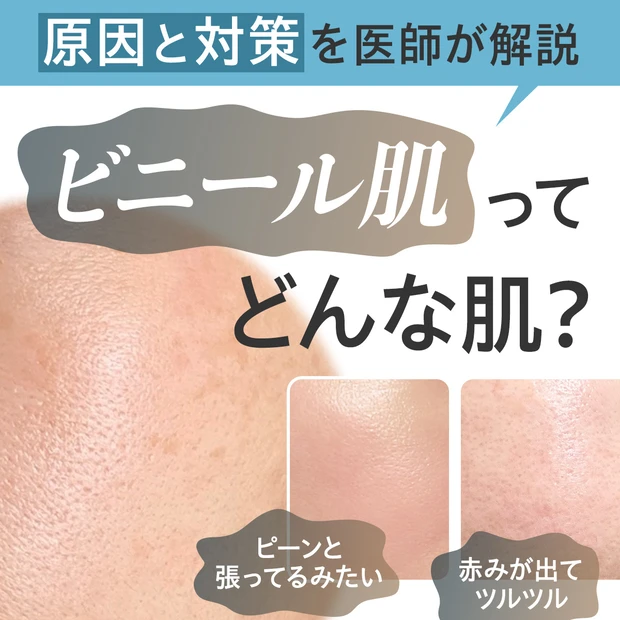 「ビニール肌」ってどんな肌？ 原因と対処法を医師が解説