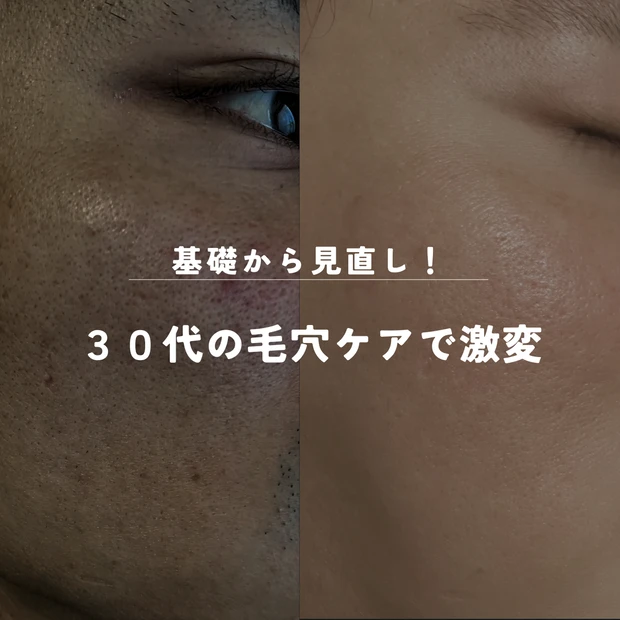 【アラサー独身男の実体験】この時期！特に気になる毛穴ケアに注目👀