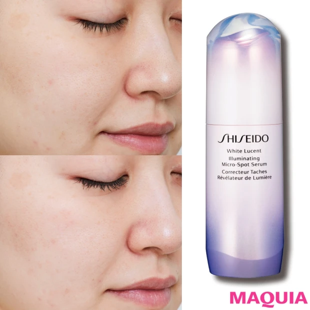 30日間で肌はどう変わる？ 千葉由佳さんが"排出美白"にチャレンジ！