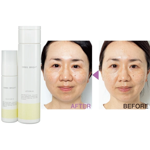 プチプラでシミケアしたい! 「オルビス ブライト」のライン使いで美肌力が…