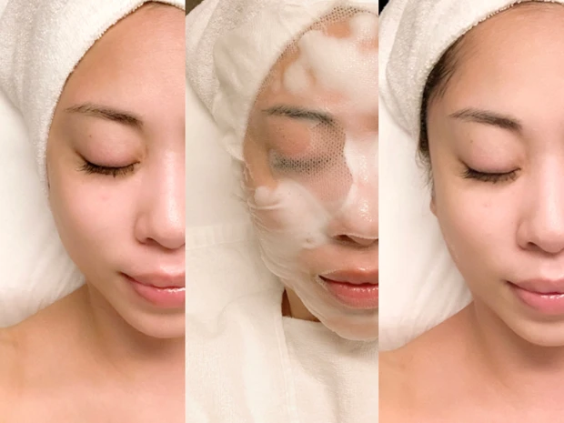 エンビロン初心者も！水素×ビタミンの力で“脱肌荒れ”を目指すフェイシャルエステ「アンジェラックススキンセンター渋谷」《秋の乾燥肌スキンケア》_4