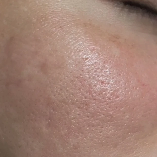 【アラサー独身男の実体験】この時期！特に気になる毛穴ケアに注目👀_3