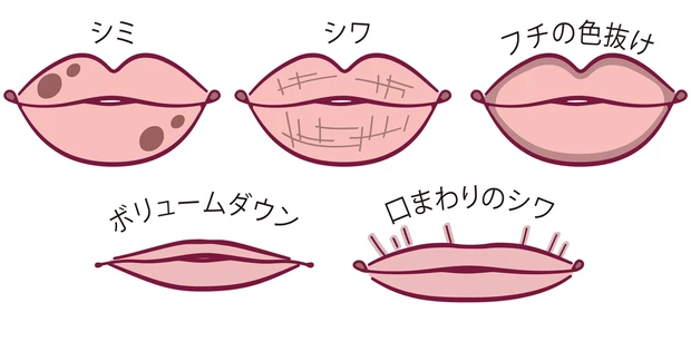 唇老けのタイプイラスト