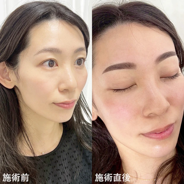 アートメイク アイブロウ Shokoさん