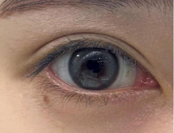 デジャヴュ ラッシュアップEのスウォッチ BEFORE