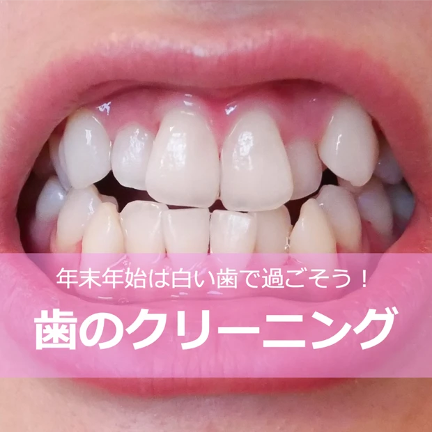【デンタルケア】歯のクリーニング「エアーフロー」がすごい！年末年始は白い歯で過ごそう