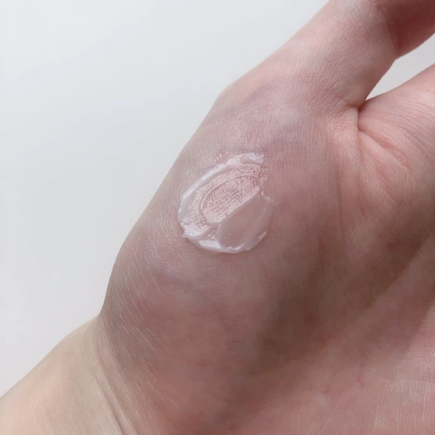 【絶対跡残さない！】肌荒れ対策、ニキビ跡ケア5選_2_2