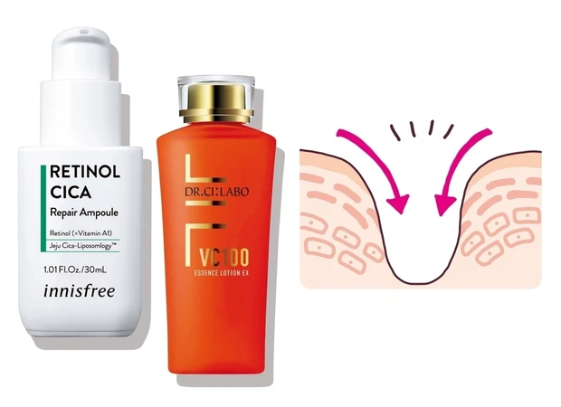 友利新先生　たるみ毛穴　毛穴　スキンケア