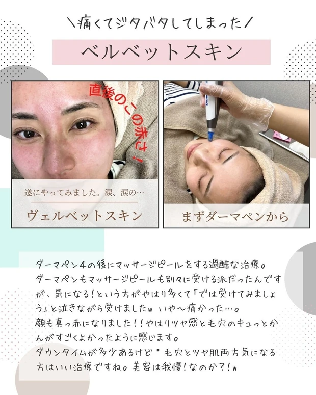 【2021年総まとめ】今年受けた美容医療!徹底解説!_3_1