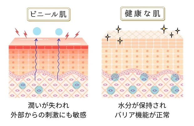 ビニール肌と健康な肌のイラスト