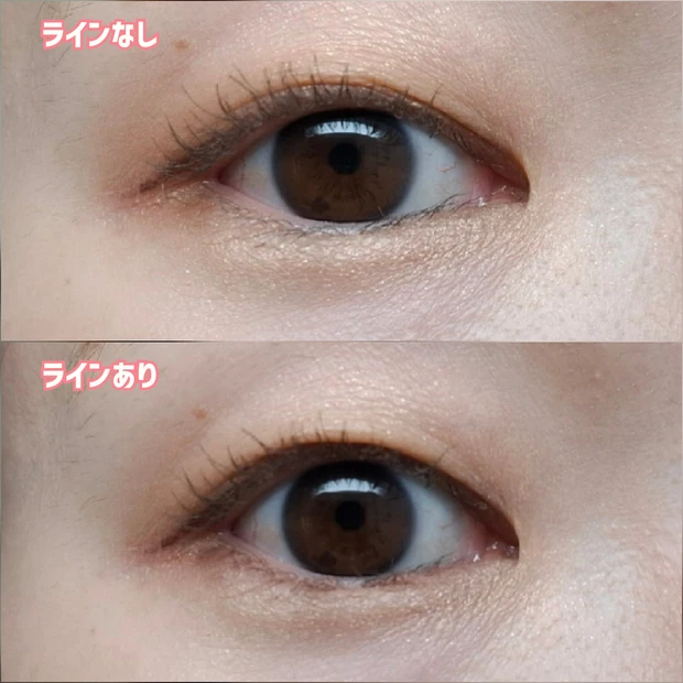 クリーミータッチライナーを粘膜に引いた様子