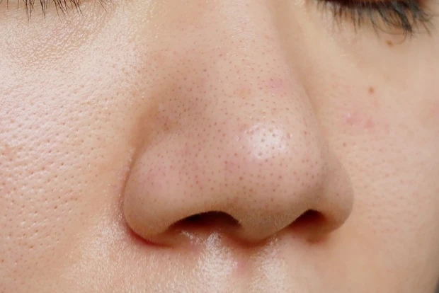 【before/after】たった14日で毛穴撲滅？イプサのポアスキンステップスを実際に使ってみました！_10_2