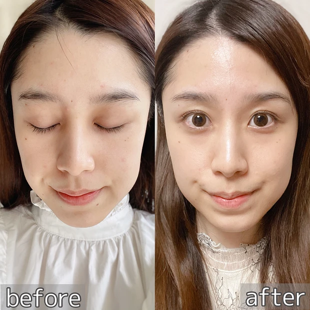 私の肌に足りなかったのは高濃度ビタミンCだった。新しくなったオバジC25セラム NEOで毛穴レスな肌へ_4