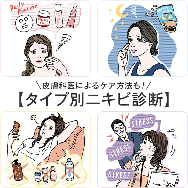 【タイプ別ニキビ診断】ライフスタイル、できるパーツからセルフチェック。医師によるケア方法の解説も！ 