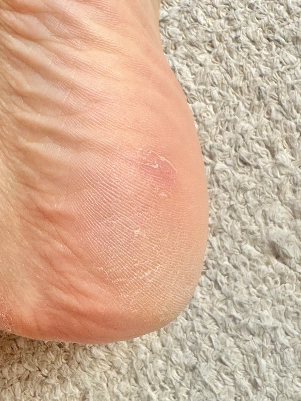 【検証】オルビスのディフェンセラでガサガサかかとがつるんとなるまでの4ヶ月を記録！_3_3