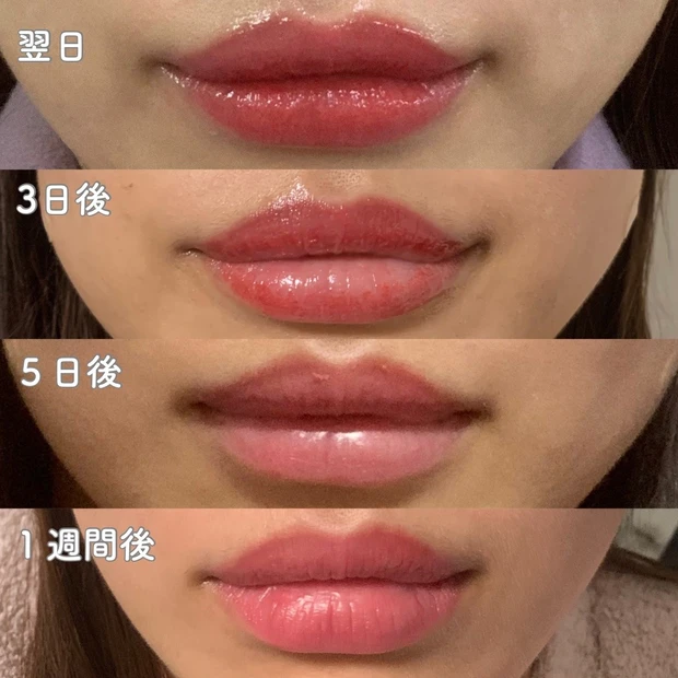 韓国リップアートメイク経過レポ