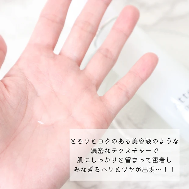 【彷徨いメラニン】を撲滅!美白もシワもWで叶う【アテニア】の欲張りローションをレビュー!_3