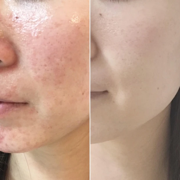 理系目線で本当に効果のある美容法を追求中！6年目上田麻里です♡_3_1