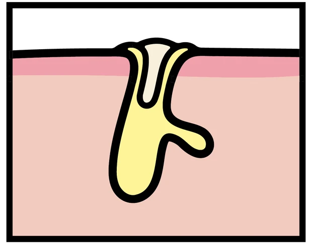 【悩み別】毛穴を目立たなくする方法 PhotoGallery_1_11