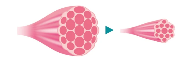 さらに加齢により眼輪筋の筋線維の数も減っていく