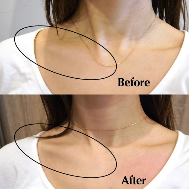 マッサージガン arboleaf 筋肉 筋膜 筋膜リリース massagegun 肩こり むくみ 小顔効果 姿勢改善 おうち美容 セルフケア 鎖骨 Amazonで買える