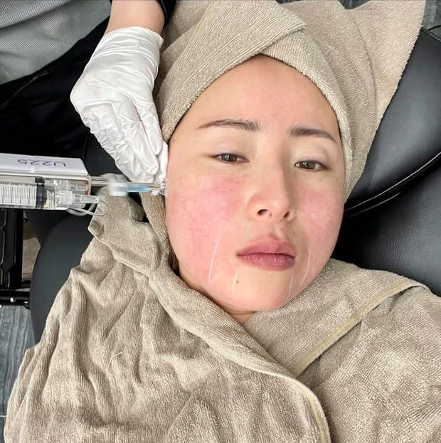 【真似しないでw】1ヶ月の美容代に28万6千円使った結果_7