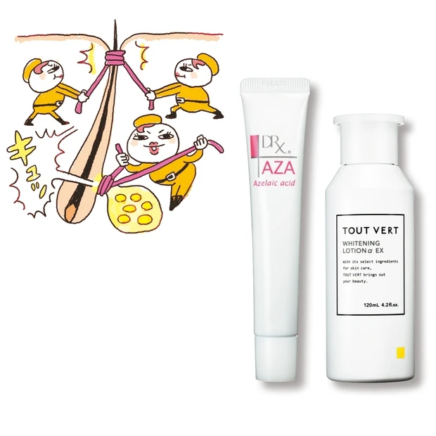 化粧品成分のプロが解説！「ニキビ・吹き出物」のお悩みが、この成分でなかっ…