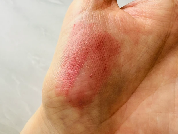 EX-2 羊雲のゆりかご