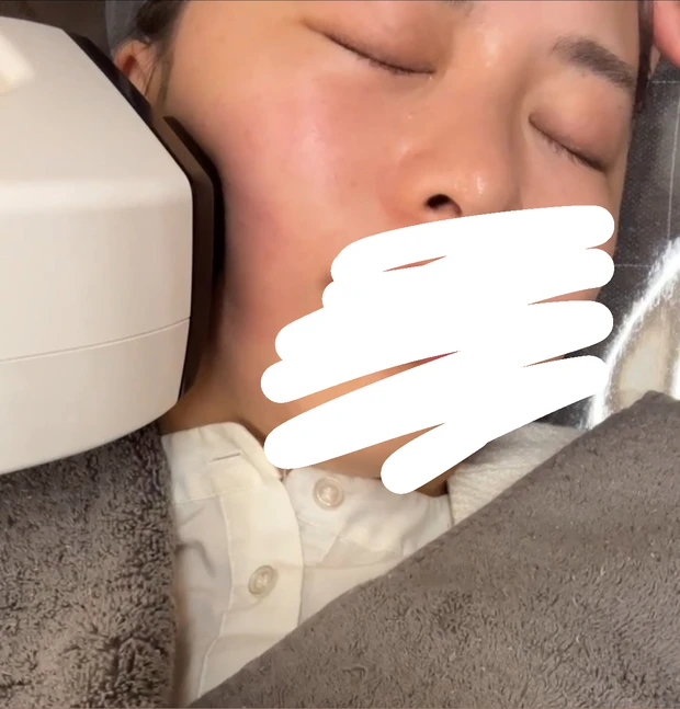 【必見】2024年やってよかった美容♡美容医療・ホームケア・美顔器、効果があったのはコレ！_5_2