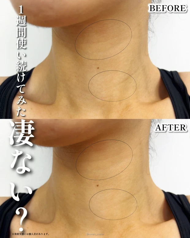 MEDIPEEL　メディピール　プレミアムペプチドナイテ1000ショットネックスティック　韓国コスメ　エイジングケア　首ケア　小田切ヒロ