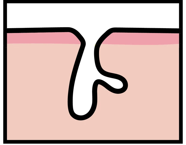 【悩み別】毛穴を目立たなくする方法 PhotoGallery_1_15