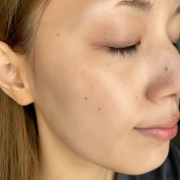 美容液ファンデ 資生堂 乾燥肌 使用感