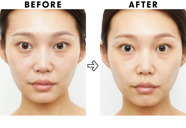 高額スキンケアの効果は？ ベスコス受賞コスメを2週間お試し PhotoGallery_1_4