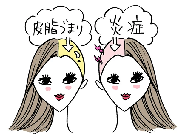 Q.頭皮の健康状態を知る方法は?