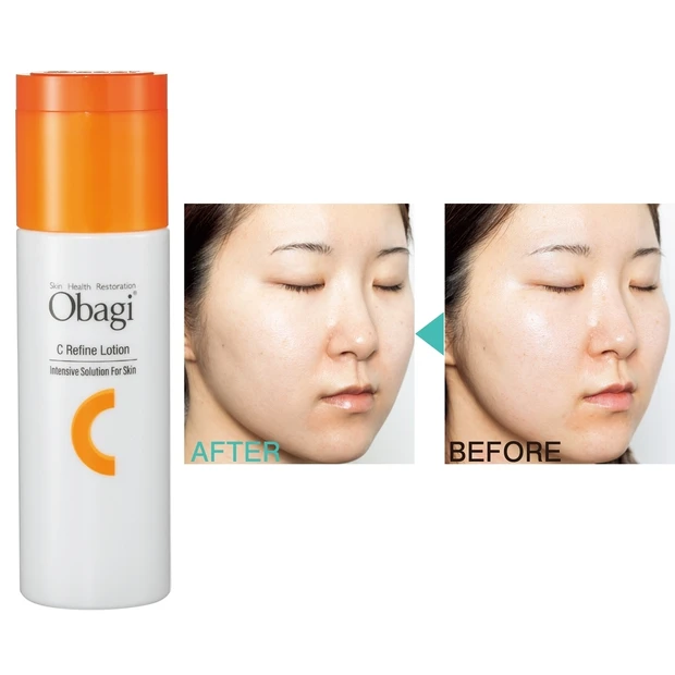 受賞ブライトニングケアをガチ試し! 「オバジ オバジC リファインローシ…