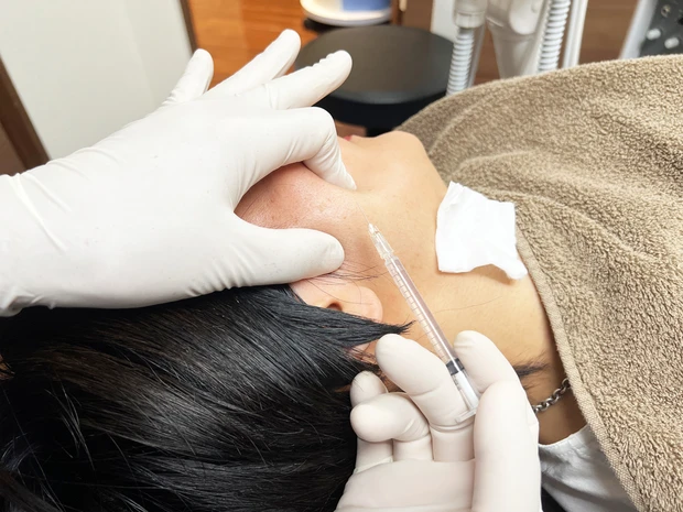 ボトックス注射 東京銀座シンタニ歯科口腔外科クリニック 体験談