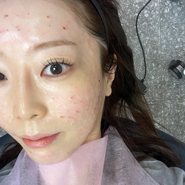 ジュベルック　効果