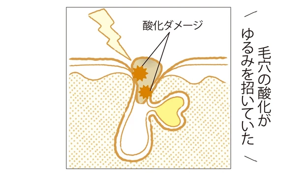 毛穴の酸化がゆるみを招いていた
