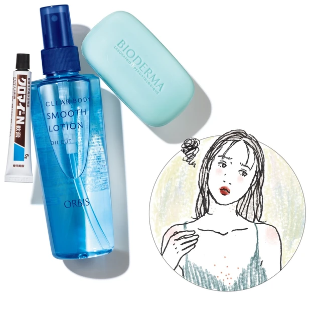 気になるボディのニキビはどうする？ 正しいセルフケア法を教えます！