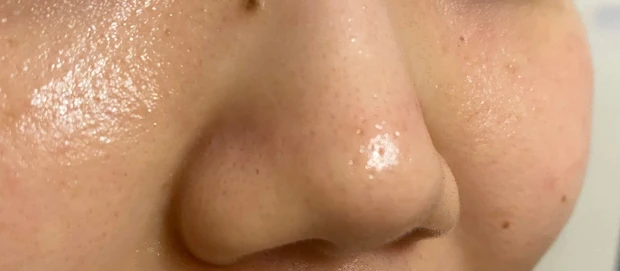 【マミ様のお墨付き！】人生初スノーピールに感動【完全無加工すっぴんレポ】_2_2